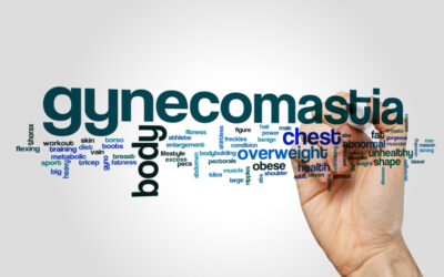 What Is Gynecomastia?