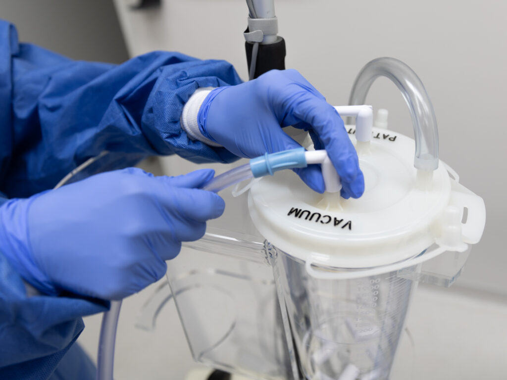 A closeup of Dr. Beck's hands, in surgical gloves and a surgery smock, setting up the vacuum system before performing liposuction for men in Dallas.