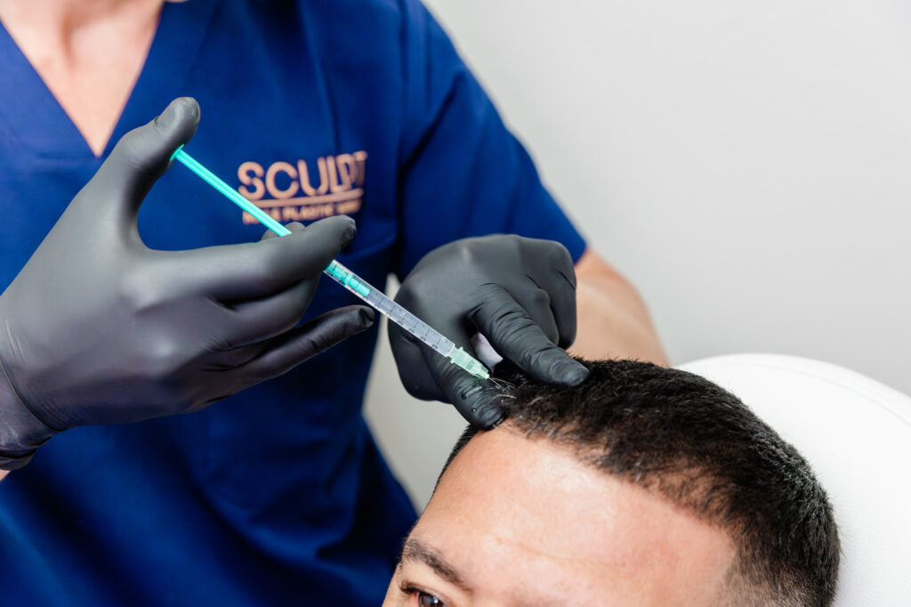 A SCULPT provider wearing black surgical gloves holds a hypodermic to a male patient's scalp. The patient is receiving a stem cell injection for regenerative medicine near McKinney.